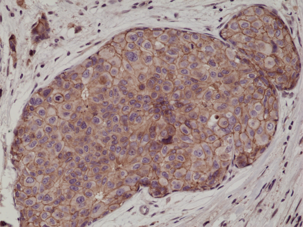 Anti-E-Cadherin (CDH1) Rabbit Monoclonal Antibody, Clone RM244