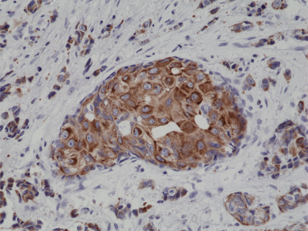 Anti-CK18 (Cytokeratin-18) Rabbit Monoclonal Antibody Rabbit Monoclonal Antibody, Clone RM279