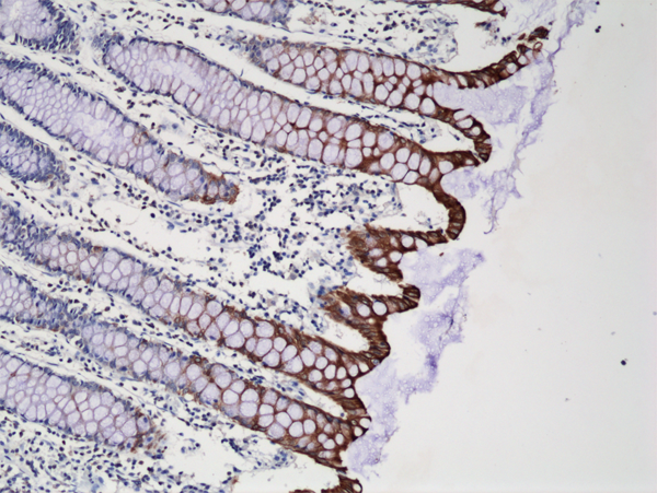 Anti-CK20 (Cytokeratin-20) Rabbit Monoclonal Antibody Rabbit Monoclonal Antibody, Clone RM283