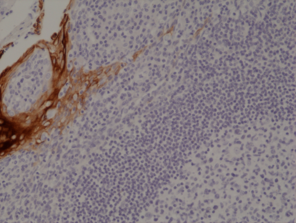Anti-CK4 (Cytokeratin-4) Rabbit Monoclonal Antibody, Clone RM355