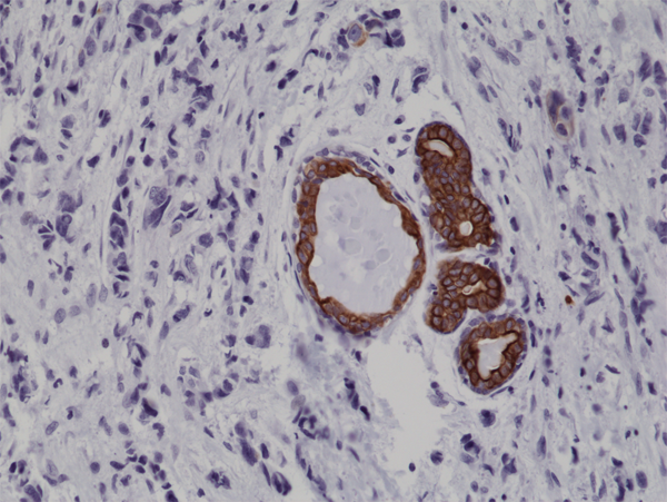 Anti-CK7 (Cytokeratin-7) Rabbit Monoclonal Antibody Rabbit Monoclonal Antibody, Clone RM284