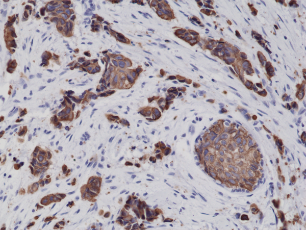 Anti-CK8 (Cytokeratin-8) Rabbit Monoclonal Antibody Rabbit Monoclonal Antibody, Clone RM266