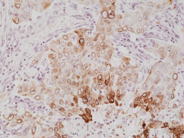 Anti-COX-2 Rabbit Monoclonal Antibody, Clone RM348