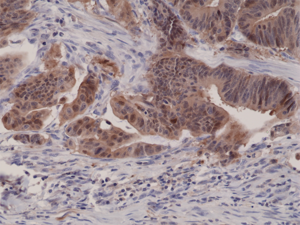 Anti-p16INK4a (CDKN2A) Rabbit Monoclonal Antibody Rabbit Monoclonal Antibody, Clone RM267