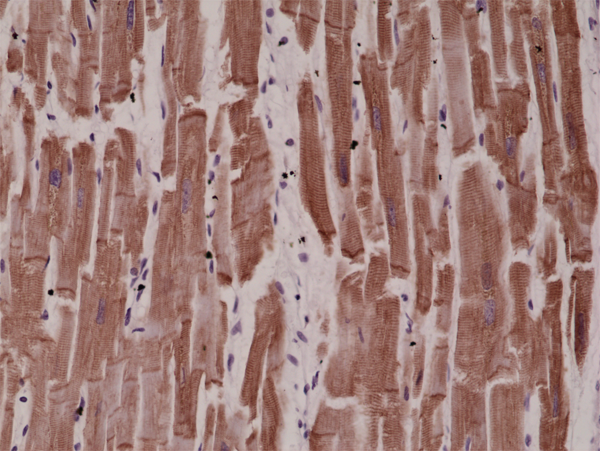 Anti-Desmin (DESM) Rabbit Monoclonal Antibody, Clone RM234