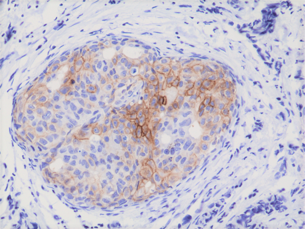Anti-Phospho-EGFR (Y1173) Rabbit Monoclonal Antibody Rabbit Monoclonal Antibody, Clone RM269