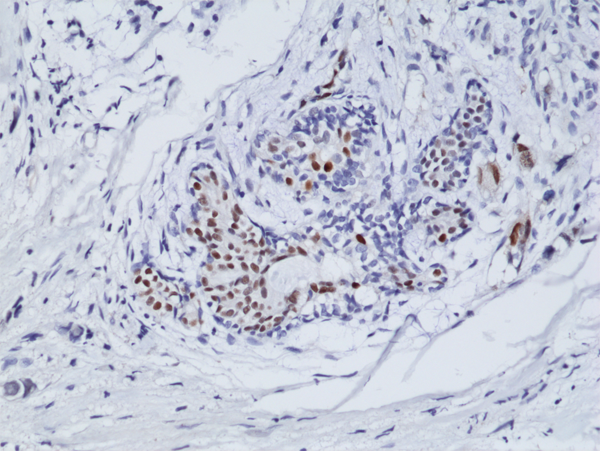 Anti-ER-alphaRabbit Monoclonal Antibody Rabbit Monoclonal Antibody, Clone RM292
