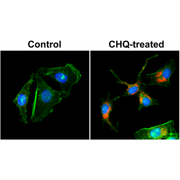Anti-LC3B Rabbit Monoclonal Antibody Rabbit Monoclonal Antibody, Clone RM293