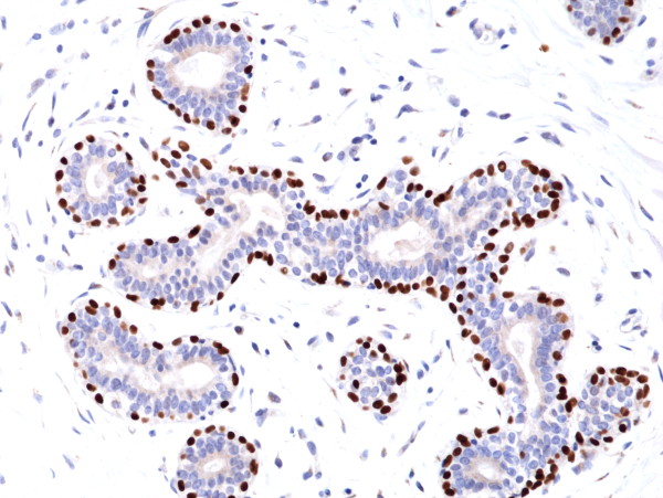 Anti-p63 Rabbit Monoclonal Antibody, Clone RM383: NEW CLONE with Improved Performance!