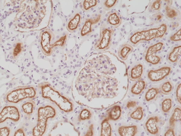 Anti-CD10 Rabbit Monoclonal Antibody, Clone RM337