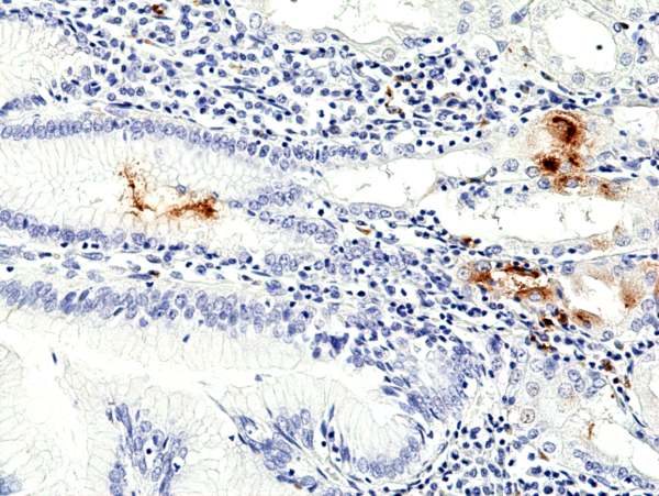 Anti-Helicobacter Pylori (H.Pylori) Rabbit Monoclonal Antibody, Clone RM429