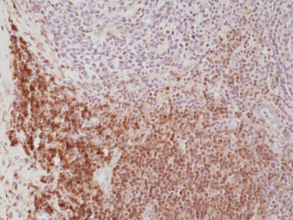Anti-CD4 Rabbit Monoclonal Antibody, Clone RM323