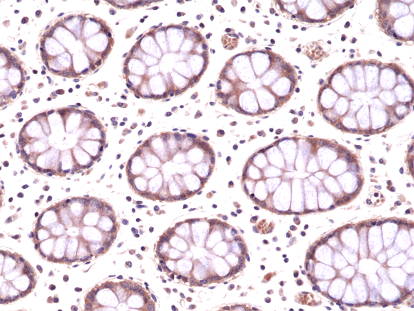 Anti-AMPK alpha-1 Rabbit Monoclonal Antibody Rabbit Monoclonal Antibody, Clone RM301