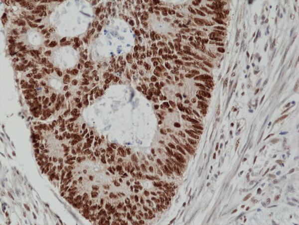 Anti-MSH2 Rabbit Monoclonal Antibody, Clone RM375
