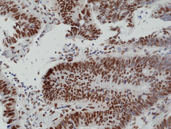 Anti-MSH6 Rabbit Monoclonal Antibody, Clone RM376