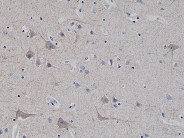 Anti-Neurofilament-L (NF-L)  Rabbit Monoclonal Antibody Rabbit Monoclonal Antibody, Clone RM280