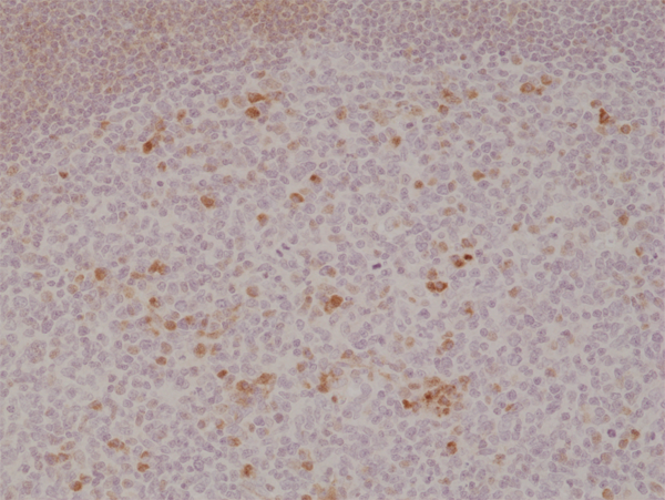 Anti-OX40 (CD134) Rabbit Monoclonal Antibody, Clone RM313