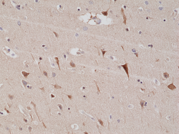 Anti-PSD95 Rabbit Monoclonal Antibody Rabbit Monoclonal Antibody, Clone RM288