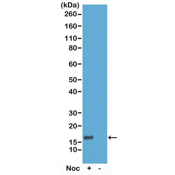 Anti-Phospho-Histone H3 (Thr6) Rabbit Monoclonal Antibody, Clone RM160