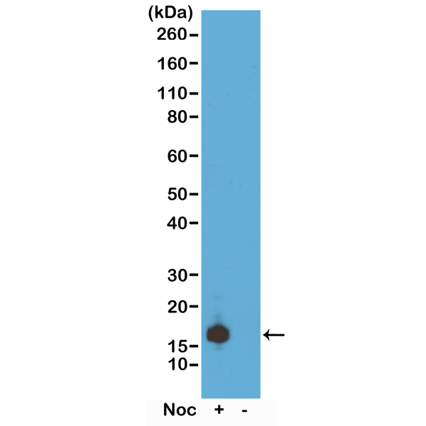 Anti-Phospho-Histone H3 (Ser10) Rabbit Monoclonal Antibody, Clone RM163