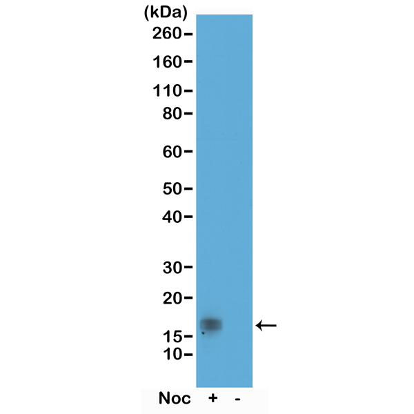 Anti-Phospho-Histone H3 (Thr11) Rabbit Monoclonal Antibody, Clone RM164
