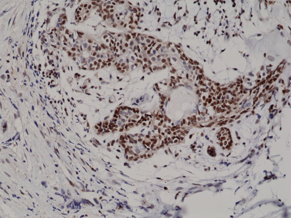 Anti-p27 Kip1 Rabbit Monoclonal Antibody Rabbit Monoclonal Antibody, Clone RM302