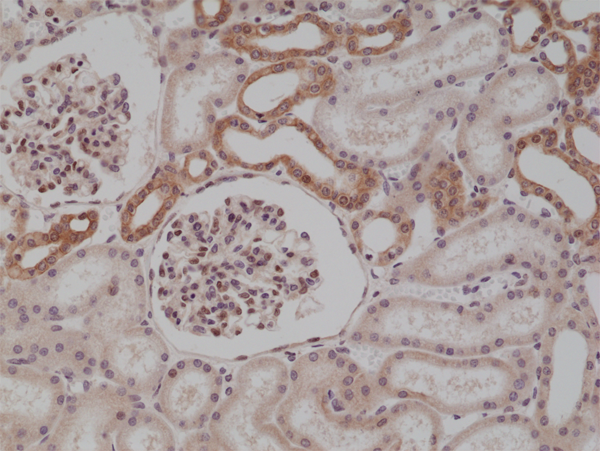 Anti-MyD88 Rabbit Monoclonal Antibody Rabbit Monoclonal Antibody, Clone RM306
