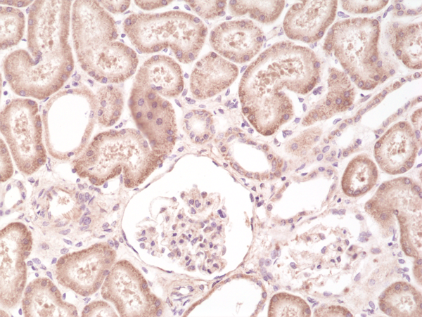 Anti-B-RAF Rabbit Monoclonal Antibody Rabbit Monoclonal Antibody, Clone RM308