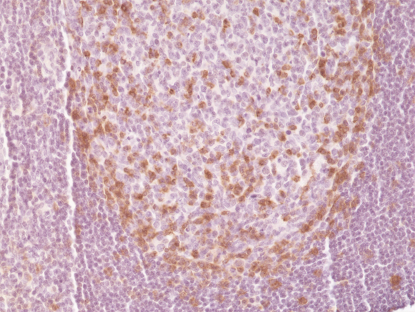 Anti-PD-1 (CD279) Rabbit Monoclonal Antibody Rabbit Monoclonal Antibody, Clone RM309