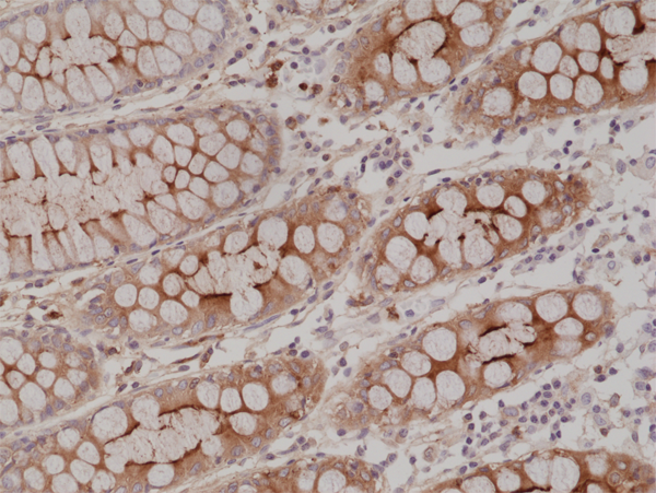 Anti-CEA (Carcinoembryonic Antigen) (CD66e) Rabbit Monoclonal Antibody, Clone RM326