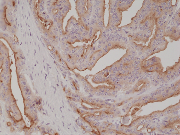 Anti-PSMA (Prostate specific membrane antigen) Rabbit Monoclonal Antibody, Clone RM327
