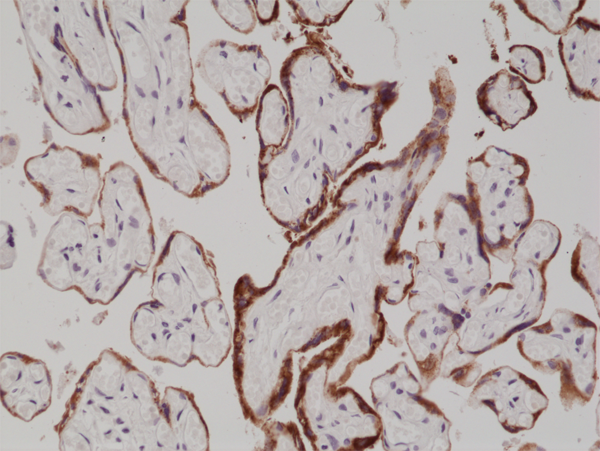 Anti-hCG (Human Chorionic Gonadotropin) Rabbit Monoclonal Antibody, Clone RM330