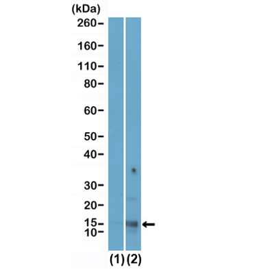 Anti-Acetyl-Histone H2A.X (Lys9) Rabbit Monoclonal Antibody, Clone RM446