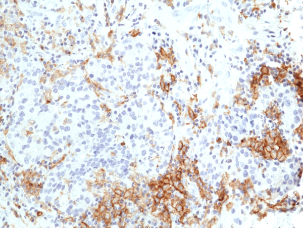 Anti-TIM3 (Hepatitis A virus cellular receptor 2) Rabbit Monoclonal Antibody, Clone RM448