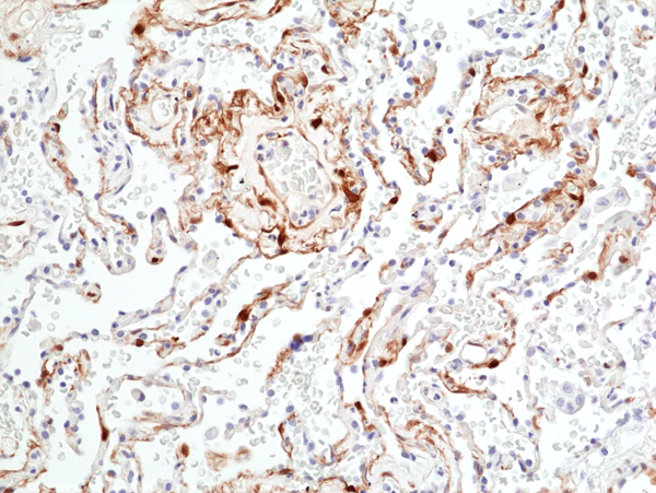 Anti-Phospho-p44/42 MAPK (Erk1/2) (Thr202/Tyr204) Rabbit Monoclonal Antibody, Clone RM451