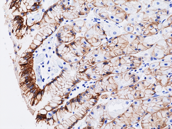 Anti-CLDN 18.2 Rabbit Monoclonal Antibody, Clone RM510