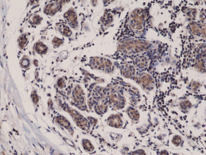 Immunohistochemical