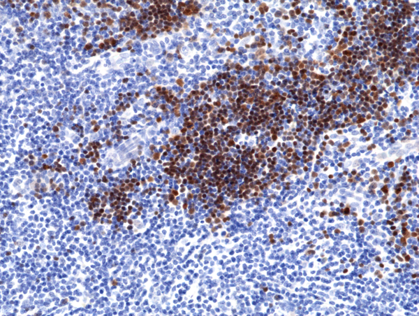 Anti-Terminal deoxynucleotidyl transferase (TdT) Rabbit Monoclonal Antibody, Clone RM379