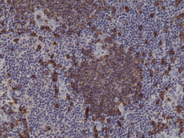 Anti-CD20 Rabbit Monoclonal Antibody Rabbit Monoclonal Antibody, Clone RM272
