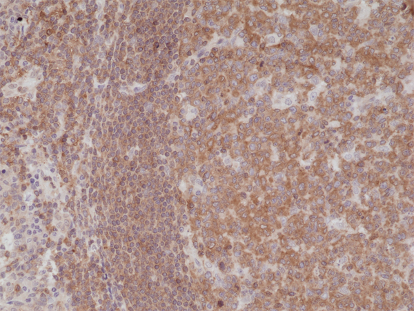 Anti-NF-kappa-B p105/p50 (NFkB) Rabbit Monoclonal Antibody Rabbit Monoclonal Antibody, Clone RM299