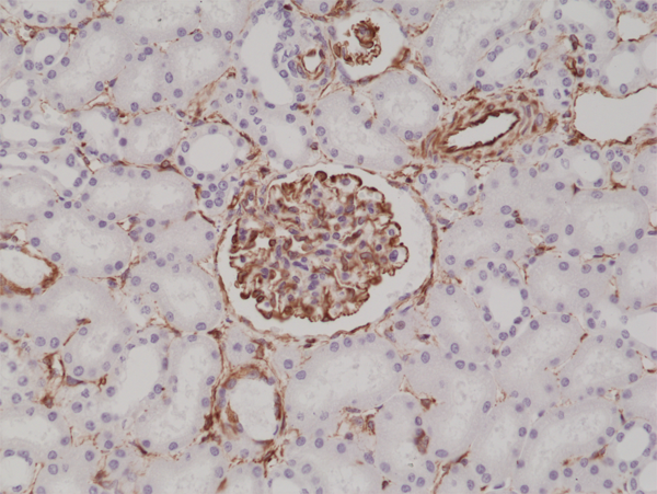 Anti-Vimentin Rabbit Monoclonal Antibody Rabbit Monoclonal Antibody, Clone RM289