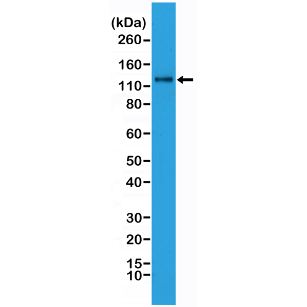 Anti-N-Cadherin (CDH2) Rabbit Monoclonal Antibody, Clone RM259