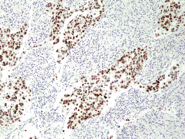 Anti-p53 Rabbit Monoclonal Antibody, Clone RM387
