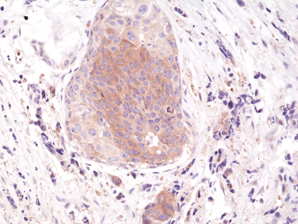 Anti-eIF-2 &alpha; (pS51) Rabbit Monoclonal Antibody Rabbit Monoclonal Antibody, Clone RM298