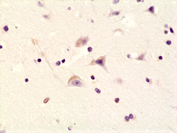 Anti-Phospho-AMPA Receptor (GluR 1) (Ser845) Rabbit Monoclonal Antibody Rabbit Monoclonal Antibody, Clone RM296