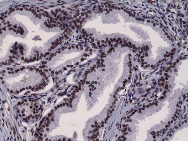 Anti-Androgen Receptor (N-Term) Rabbit Monoclonal Antibody, Clone RM254