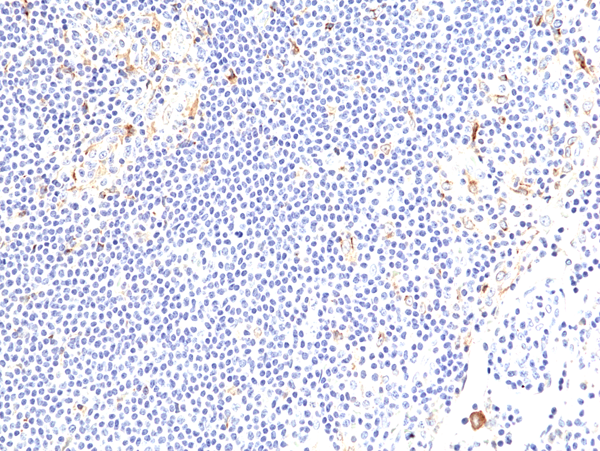 Anti-4-1BB (CD137) Rabbit Monoclonal Antibody, Clone RM471