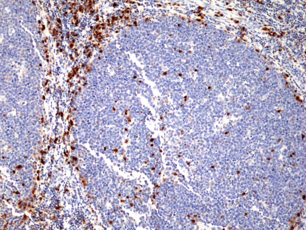 Anti-MUM1/IRF4 Rabbit Monoclonal Antibody, Clone RM352