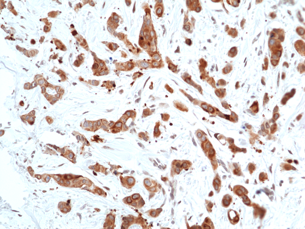 Anti-Phospho-GSK-3&beta; (Ser9) Rabbit Monoclonal Antibody, Clone RM453