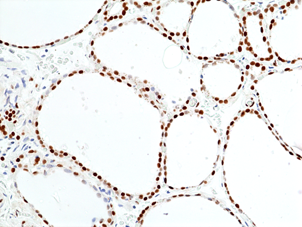 Anti-INI1(SNF5/SMARCB1) Rabbit Monoclonal Antibody, Clone RM468